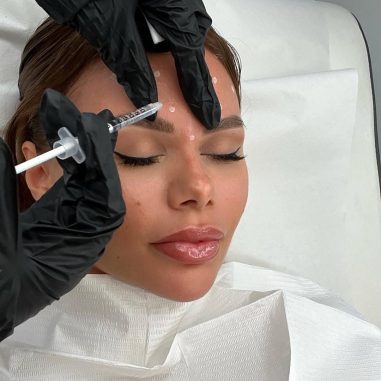 botox-prevention