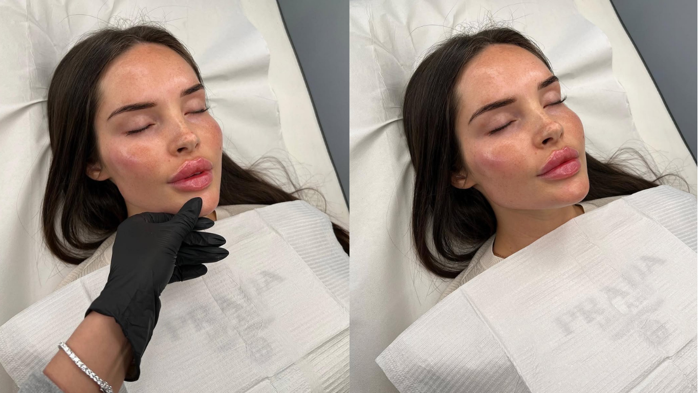 soft-surgery