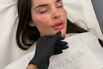 soft surgery