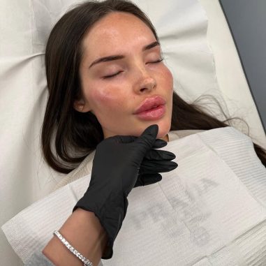 soft surgery