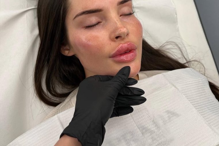soft surgery