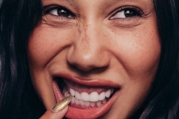gummy-smile