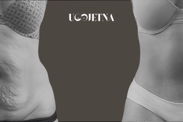 abdominoplastika