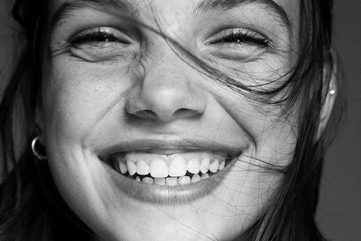 gummy smile