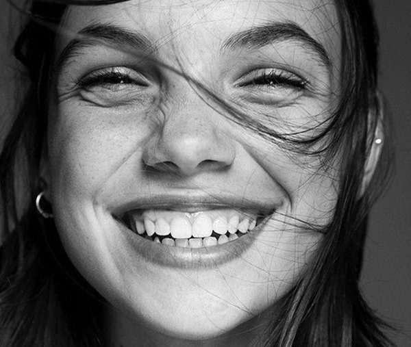 gummy smile