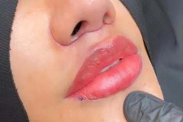 lip-lift-tanke-usne