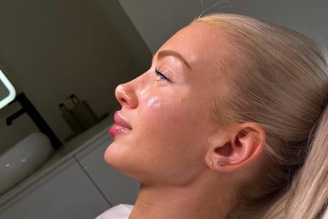 Liquid rinoplastika