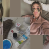 blefaroplastika oporavak