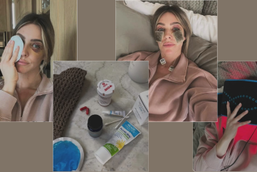 blefaroplastika oporavak