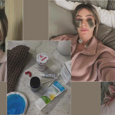 blefaroplastika oporavak