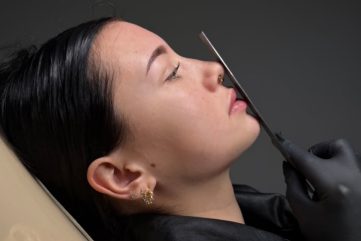 Profiloplastika filerima i konturiranje lica bez odlaska 'pod nož'
