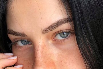 browlift