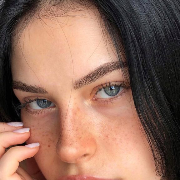browlift